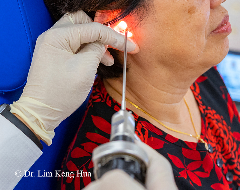 Ear Scope Dr KH Lim ENT Clinic